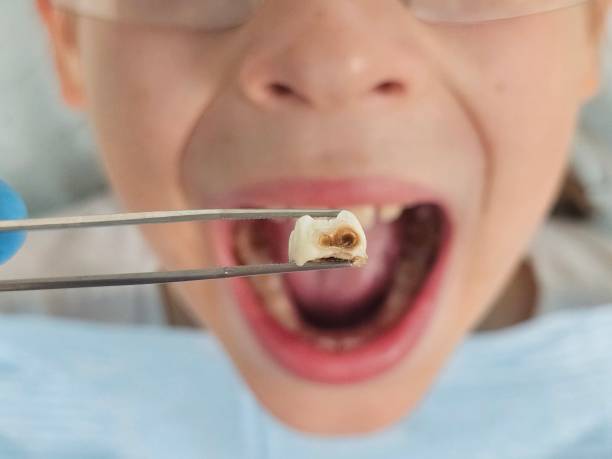 Best Emergency Dental Care for Abscessed Tooth in Factoryville, PA